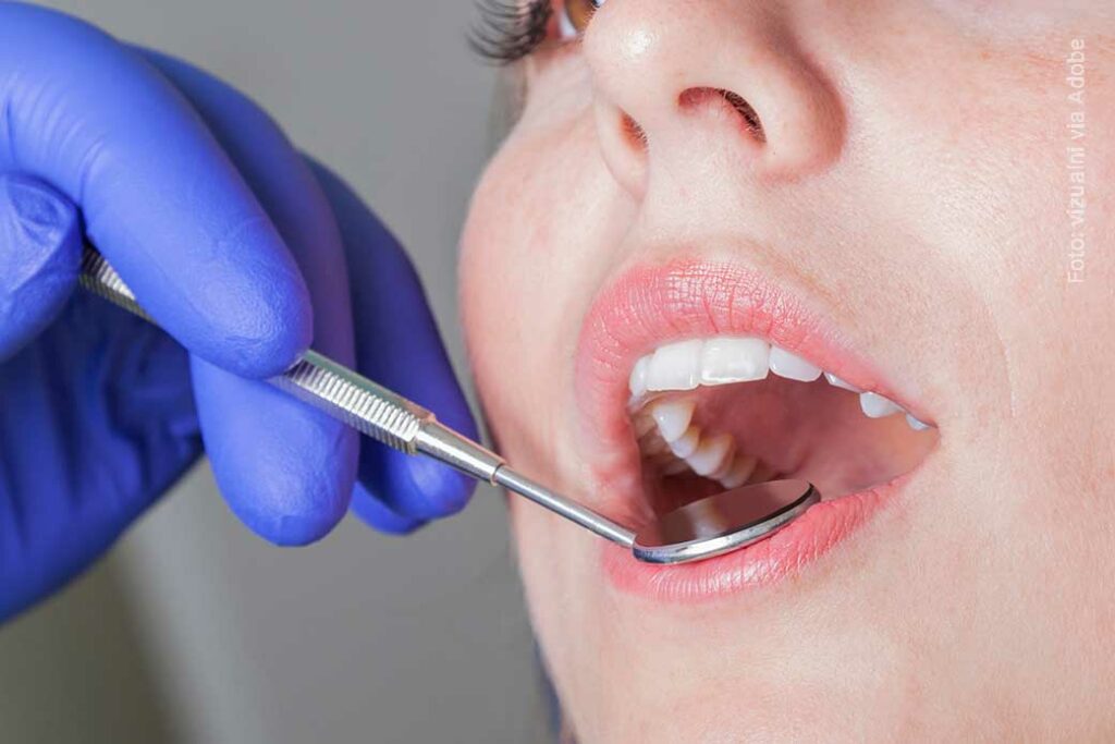Regelmäßige Kontrollen helfen, die Zähne gesund zu halten. Unser Tipp: Kommen Sie regelmäßig zur Kontrolle - Zahnarztpraxis Dr. Fleischer, Ihr Zahnarzt mit Herz in Dortmund, Foto: vizualni via Adobe